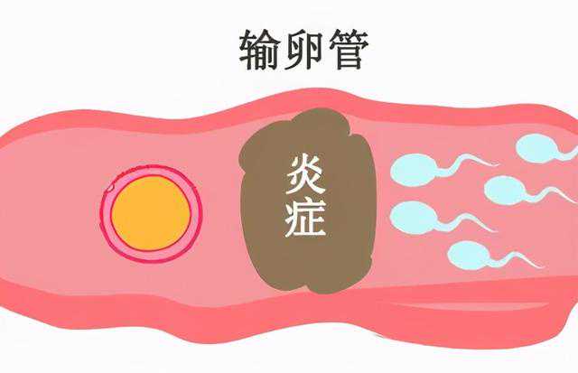 贵州大的代孕公司-贵州供卵医疗机构-贵州做试管用供精成功率